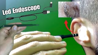 3 in 1 USB Ear Cleaning Endoscope [upl. by Oemor]