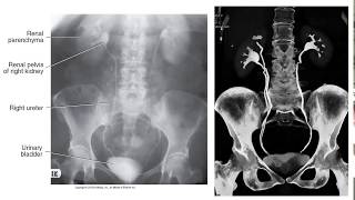 Retrograde  Ascending Urethrography Procedures preparation guide [upl. by Gabe]