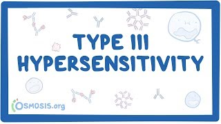 Type III hypersensitivity immune complex mediated  causes symptoms amp pathology [upl. by Wiatt]