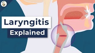 Why Do You Lose Your Voice  Laryngitis Explained [upl. by Press540]