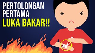 Pertolongan Pertama Luka Bakar [upl. by Naiviv]