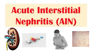 Kidney StonesNephrolithiasis Causes Pathophysiology Signs amp Symptoms Diagnosis  Treatment [upl. by Athallia]