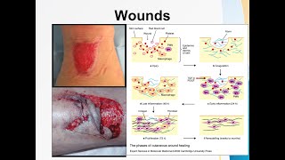 Wounds [upl. by Atalanti]