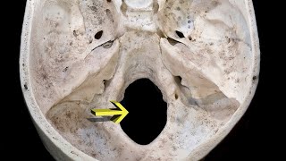 MNEMONIC  Foramen Magnum [upl. by Aibat]