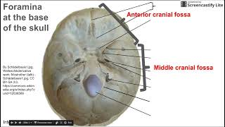 Foramina at base of skull [upl. by Barrie119]