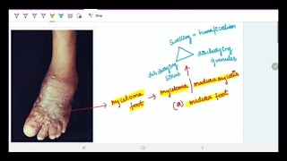 Subcutaneous Deep Mycoses  Microbiology  Image based discussion [upl. by Ferneau]