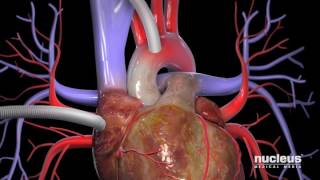 Ultrasound of the Carotid Arteries [upl. by Chesney348]