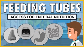 Types of Feeding Tubes EXPLAINED [upl. by Graces]