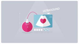 Embryo to Fetus Weeks 912 of Pregnancy  Parents [upl. by Ontina124]