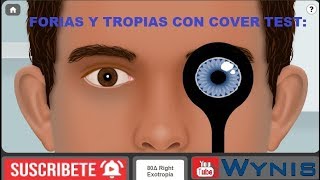 Cover Test con Forias y Tropias  Caso Real  Tests Visuales [upl. by Pallaten524]