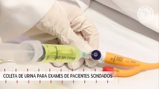 Coleta de urina para exames de pacientes sondados [upl. by Pirozzo]