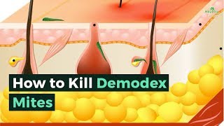 How to Kill Demodex Mites [upl. by Callan]