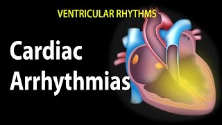 Cardiac Arrhythmias Animation [upl. by Julis]