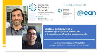 Myotonic dystrophy type 1 [upl. by Sisson]