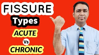 ACUTE FISSURE VS CHRONIC FISSURE  WHAT IS MAIN DIFFERENCE IN TREATMENT OPTIONS [upl. by Tempa]