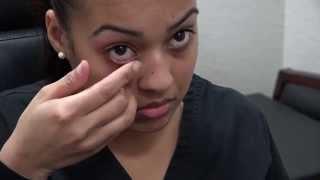 How to Apply Ointment to the Eyes and Eyelids [upl. by Lynnett]