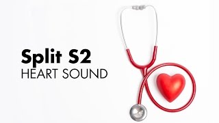 Fixed Split S2  Heart Sounds  MEDZCOOL [upl. by Wachtel937]