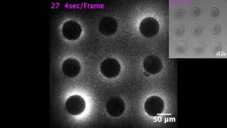 Flash of light that sparks when a sperm meets an egg [upl. by Kurr]