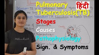 How is ptosis repair surgery done in children [upl. by Rednas21]