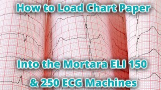 How to Load Chart Paper in the Mortara ELI 150 amp 250 ECG Machines [upl. by Anaile]