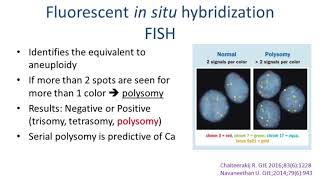 Colorectal Cancer Surgery principles and types [upl. by Ateikan]