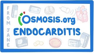 Clinicians Corner Endocarditis [upl. by Ailin]