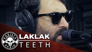 LAKLAK by Teeth  Rakista Live EP148 [upl. by Meggy]