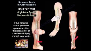 Squeeze Test In Orthopaedics  Everything You Need To Know  Dr Nabil Ebraheim [upl. by Eisso]