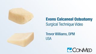 Dr Trevor Williams  Evans Calcaneal Osteotomy  CONMED Surgical Technique [upl. by Leonard]