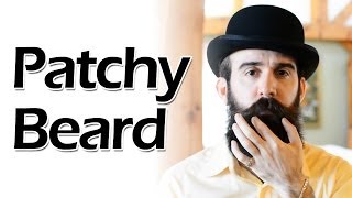 How to Deal with a Patchy Beard [upl. by Efren]