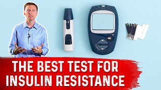 HOMAIR – The Best Insulin Resistance Test – Dr Berg [upl. by Ocinemod]