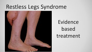 Restless Leg Syndrome evidence based treatment [upl. by Janessa265]