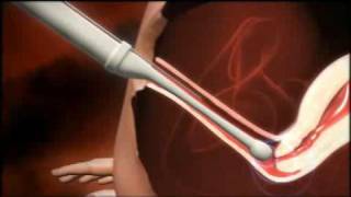 Human Physiology  Fertilization and Implantation [upl. by Antoinette]