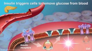 Understanding Type 2 Diabetes [upl. by Awad]