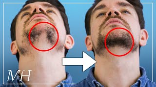 How To Fix Your Patchy Beard… Fast [upl. by Adda]