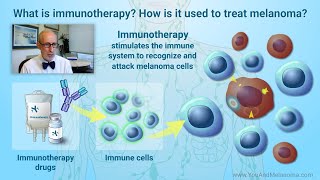 How is melanoma treated with immunotherapy [upl. by Buonomo563]