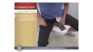 ColostomyIleostomy Emptying a Pouch [upl. by Nnaegroeg319]