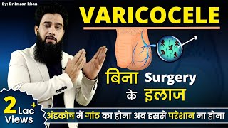 How to cure varicocele naturally [upl. by Berlinda]