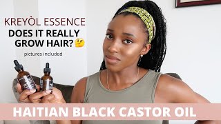 DOES IT GROW HAIR  Kreyol Essence Haitian Black Castor [upl. by Iznek212]