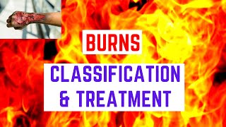 Burns  Classification and Treatment [upl. by Notsruht]