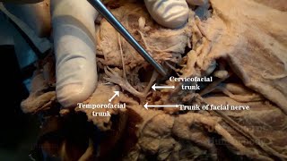 Parotid Gland II  Structures within [upl. by Bran]