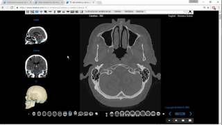 Tomografía Computada de Cabeza para Anatomía Parte 1 [upl. by Anirbus]