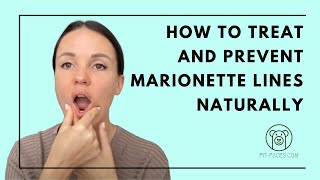 How to treat and prevent Marionette Lines naturally [upl. by Donaugh]