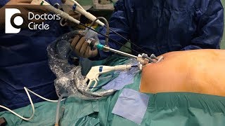 quotSingle Sitequot Robotic Surgery for Ovary Removal  Dr Dwight Im  Mercy [upl. by Lertnahs]