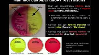 Mannitol Salt Agar MSA  Results amp Theory [upl. by Suirad]