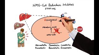 Cholesterol Treatment Guidelines and Clinical Applications in ACS Patients [upl. by Dnomhcir27]