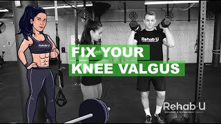 The Real Fix For Knee Valgus [upl. by Jowett951]