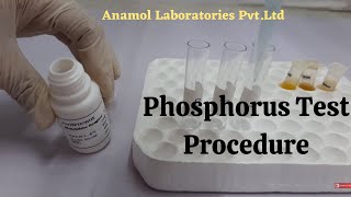 Phosphorus Test  Phosphorus Blood Test [upl. by Anaitak]