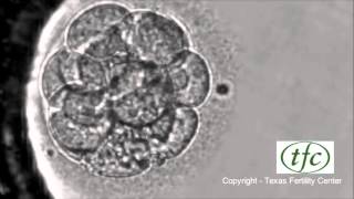 Human Embryo Growing from Fertilization to Day 6 Blastocyst [upl. by Aiht]