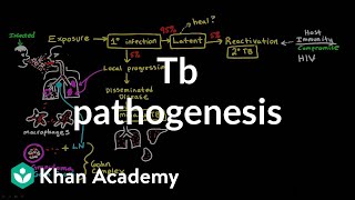 TB pathogenesis  Infectious diseases  NCLEXRN  Khan Academy [upl. by Sundberg]